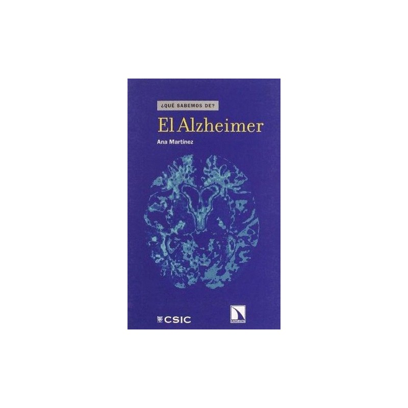 ALZHEIMER EL